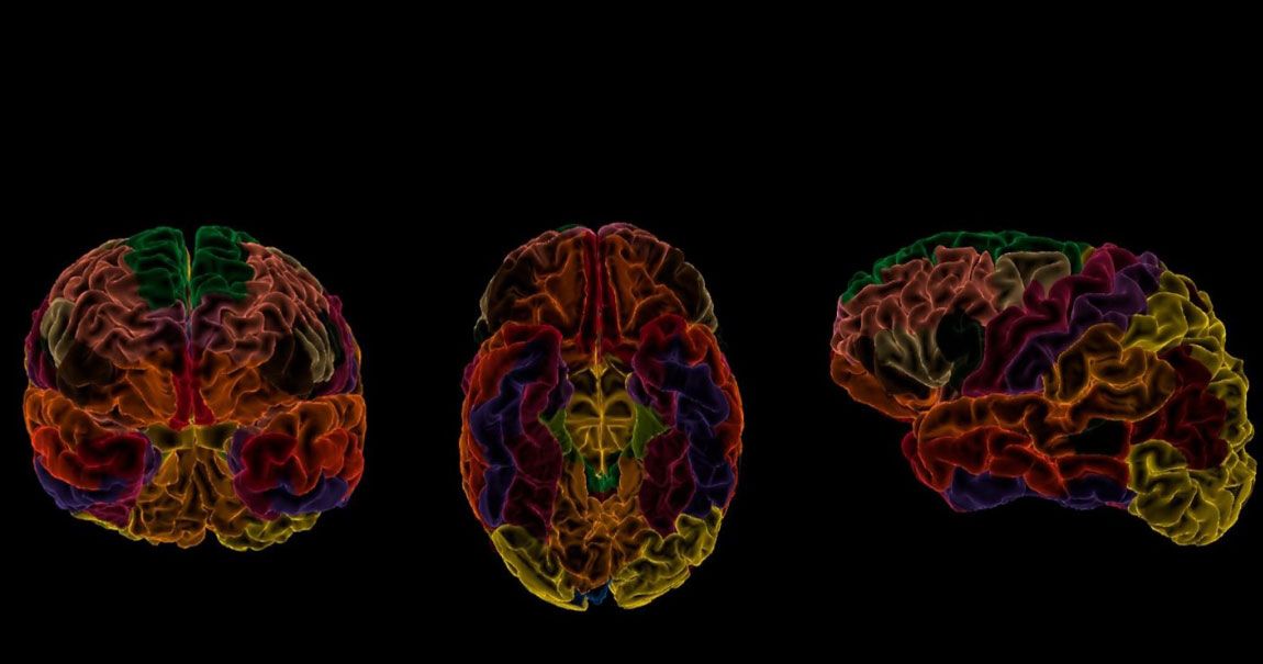 3-D image of the brain