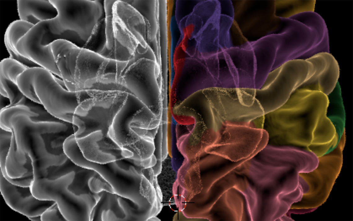 3D Imaging scan of the brain