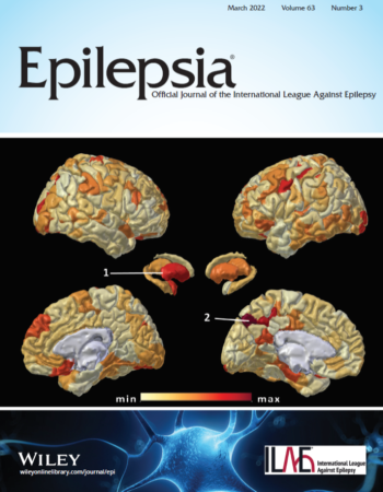 Epilepsia_cover